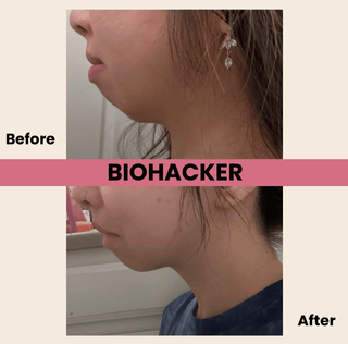 Biohackher - Biohackher Mouth Tape